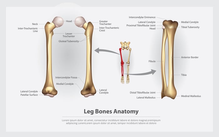 How do you treat shin splints?